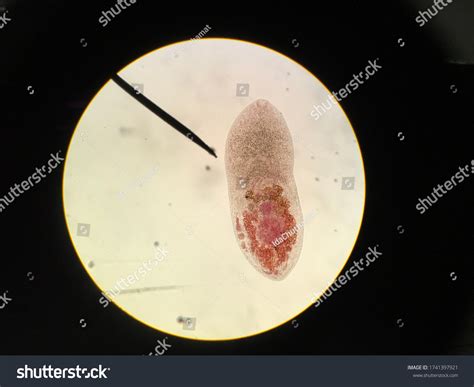  Tetracotyle! A Glimpse into the Fascinating World of This Tiny, Yet Mighty Trematode Parasite