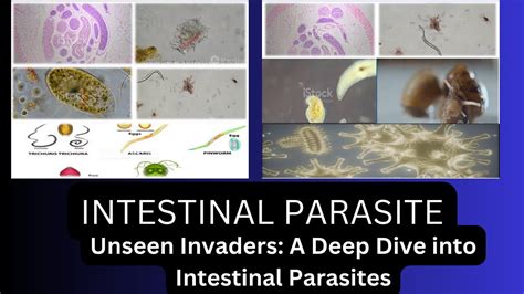  Viva the Vitellaria! A Fascinating Deep Dive into This Parasite’s Complex Lifecycle and Adaptations