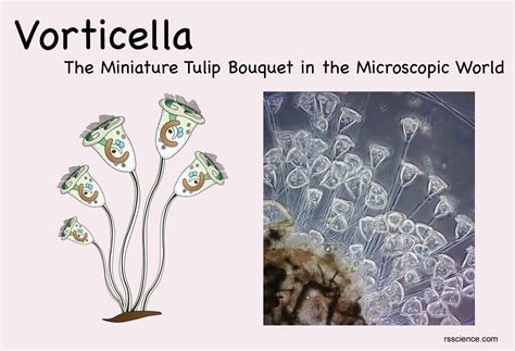 Vorticella! A Microscopic Whirlwind With Delicate Tentacles That Capture Tiny Prey.